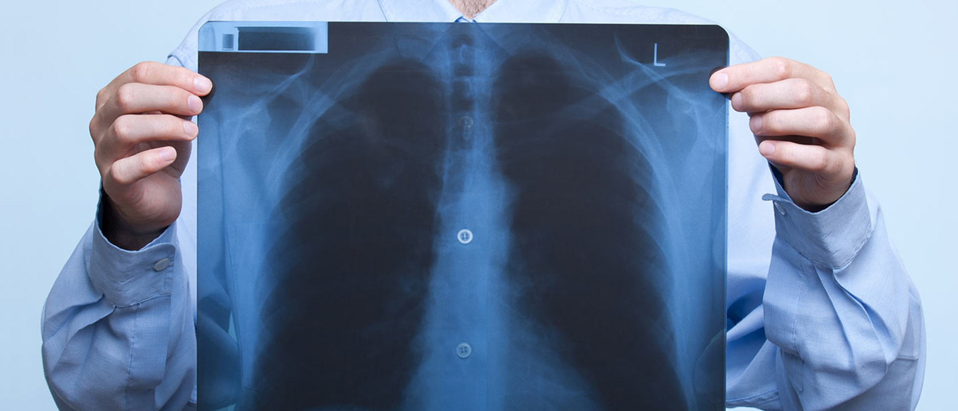 Θωρακοχειρουργικό-01