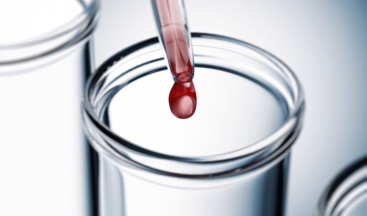 Εξετάσεις Check Up