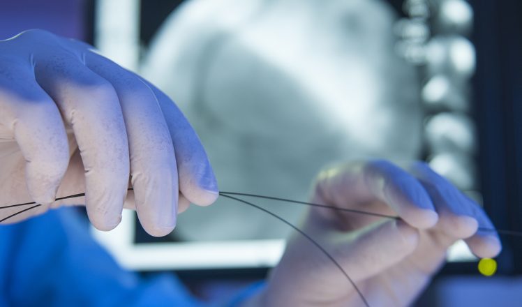 Close up of the hands with stent